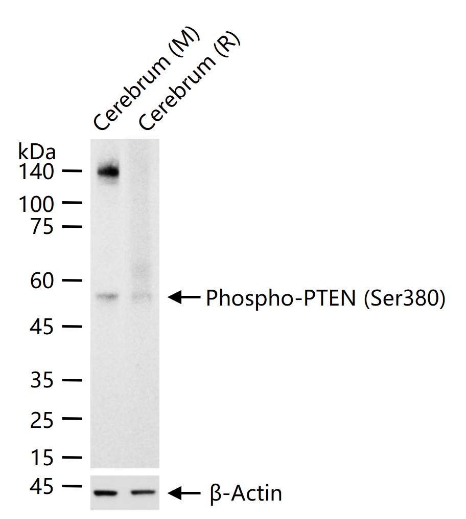 磷酸化肿瘤抑制基因PTEN重组兔单抗