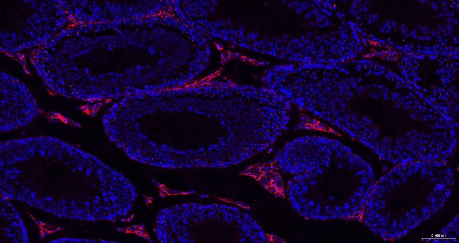 Ⅲ型胶原蛋白/胶原蛋白3/3型胶原蛋白/III型胶原抗体-bs-0549R