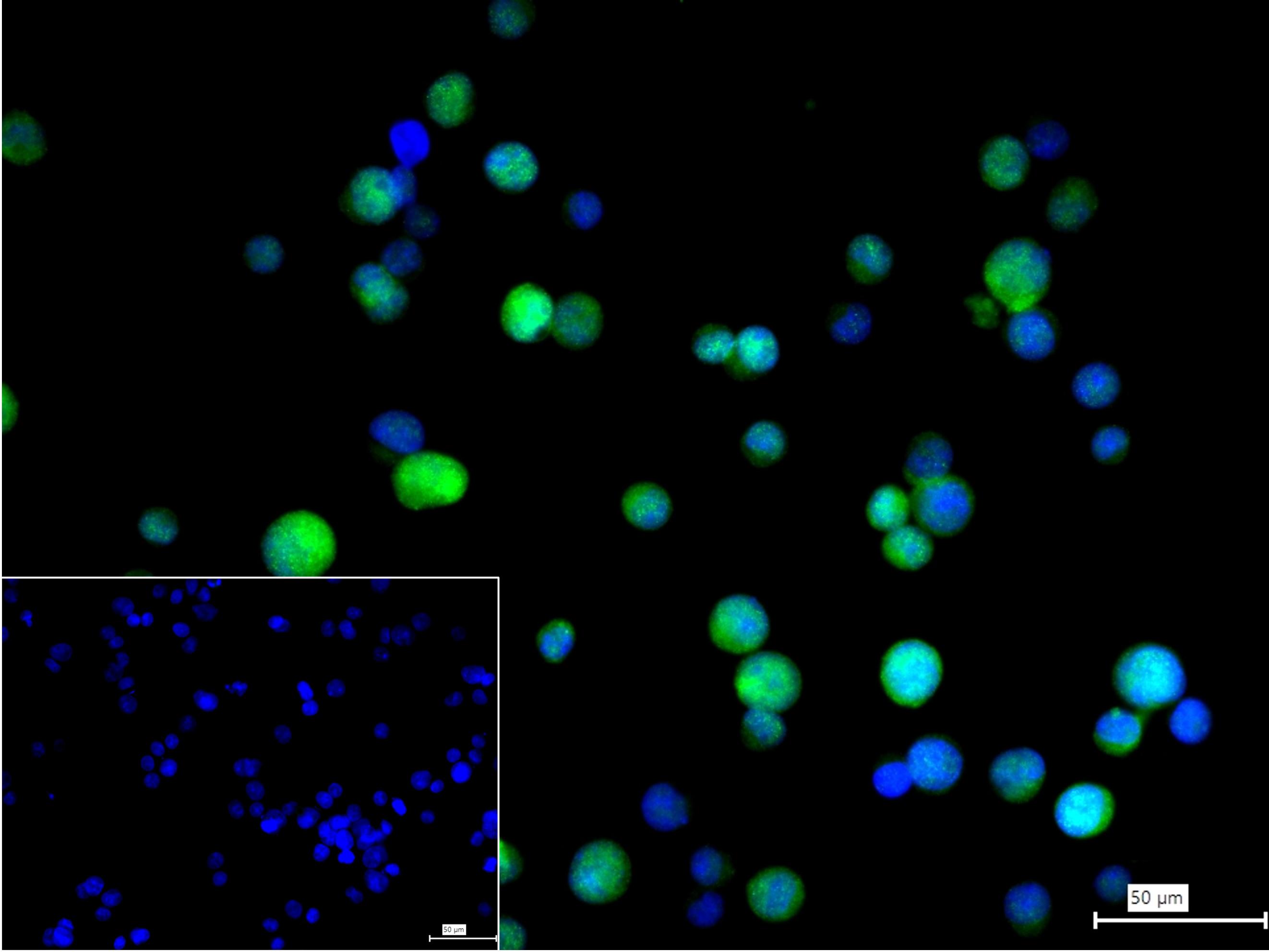 接头蛋白CrkL重组兔单抗