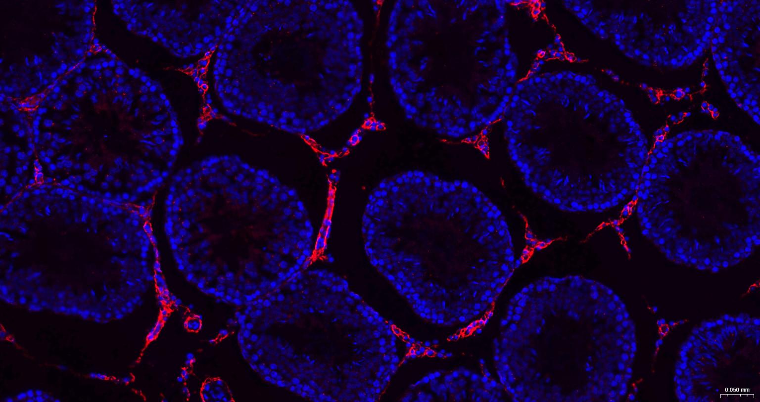 Ⅲ型胶原蛋白/胶原蛋白3/3型胶原蛋白/III型胶原抗体-bs-0549R