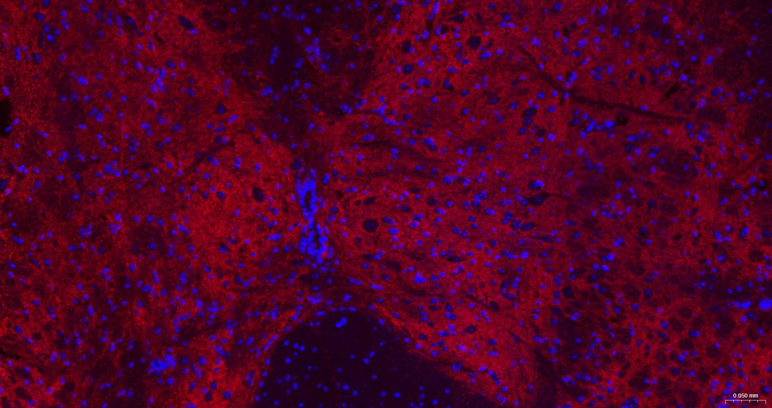 γ氨基丁酸运载蛋白1重组兔单抗