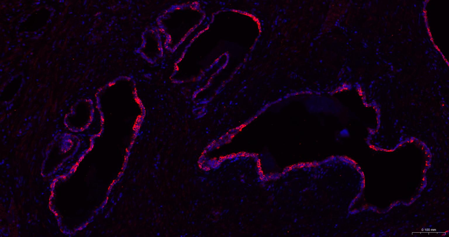 广谱细胞角蛋白PCK抗体