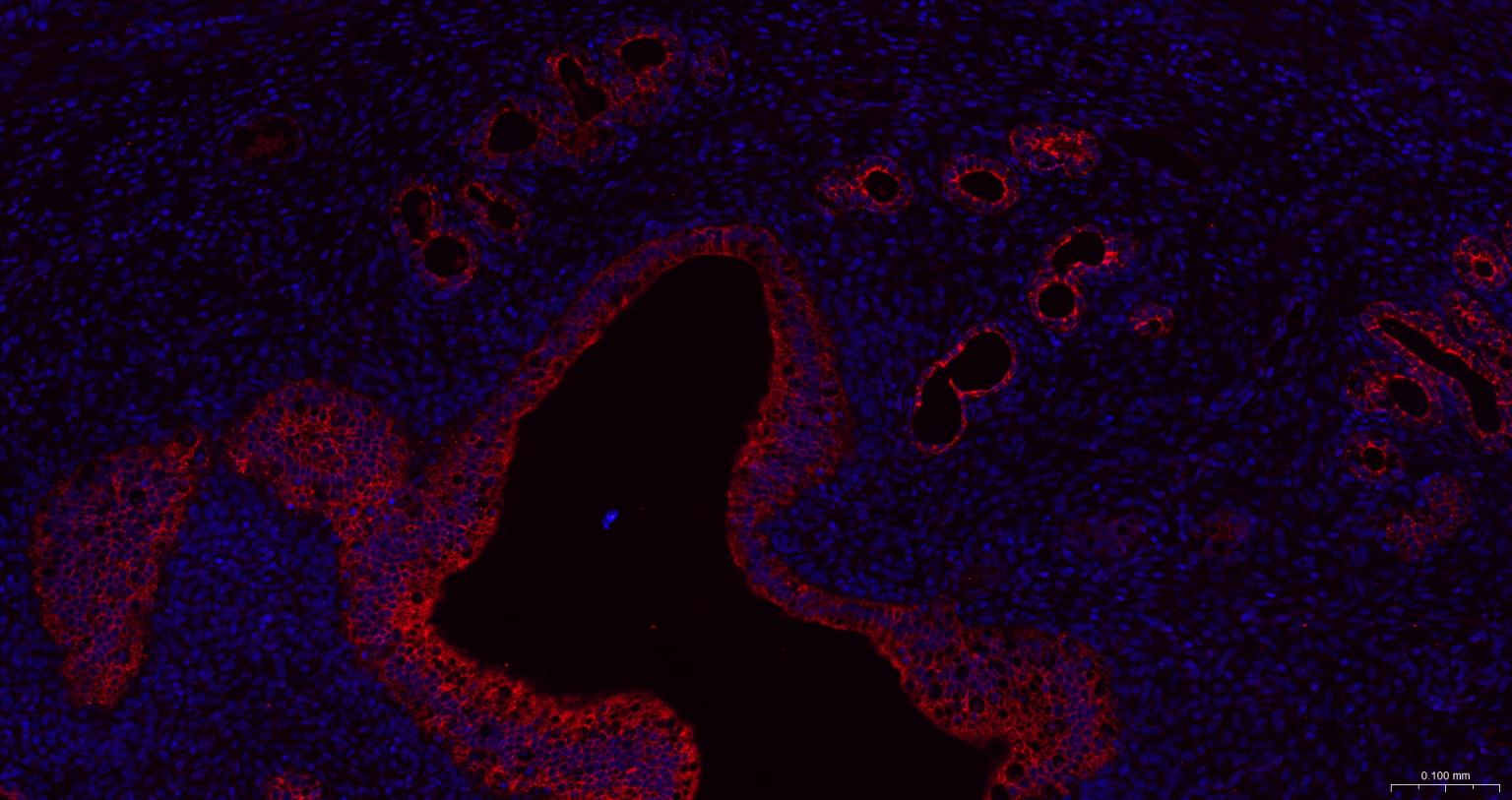 细胞角蛋白18抗体(C端)-bs-1339R