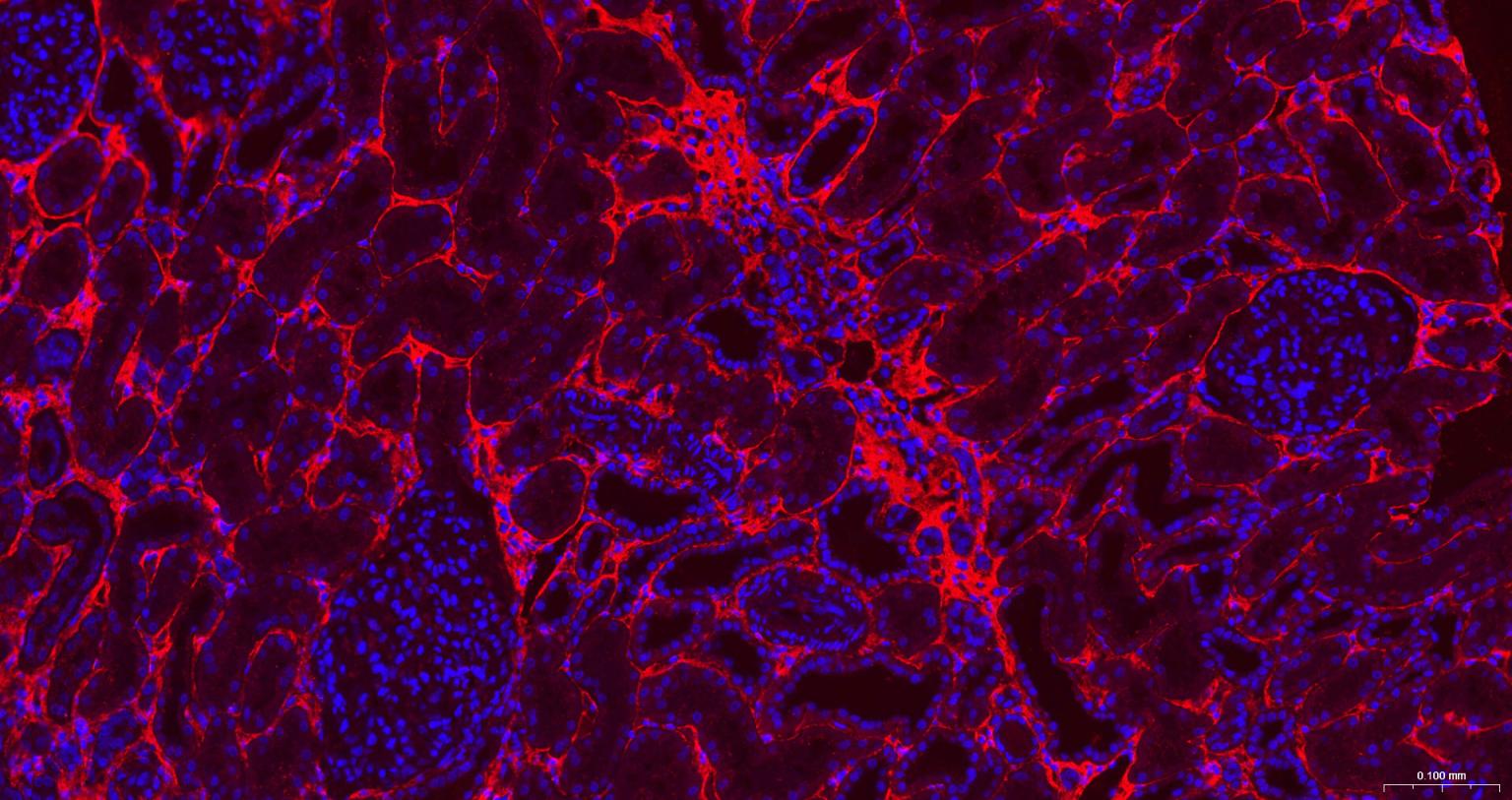 Ⅲ型胶原蛋白/胶原蛋白3/3型胶原蛋白/III型胶原抗体-bs-0549R