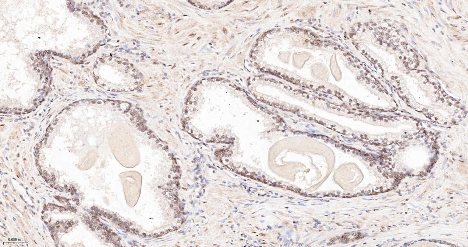 缺氧诱导因子1α抑制蛋白/HIF1AN重组兔单抗