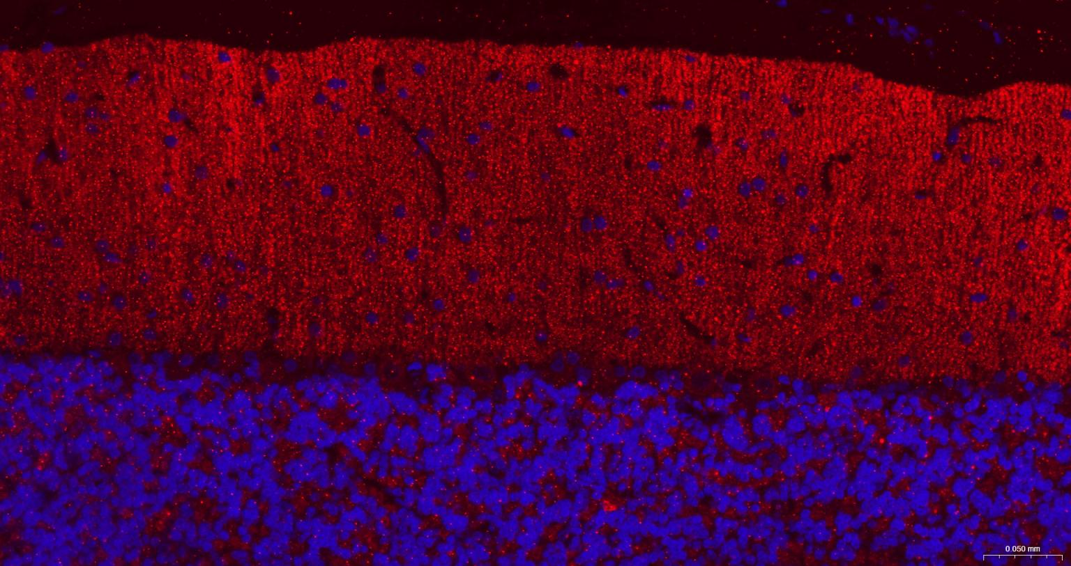 G氨基丁酸B型受体2重组兔单抗