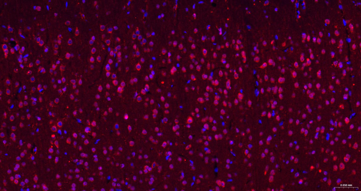 色氨酸羟化酶1重组兔单抗
