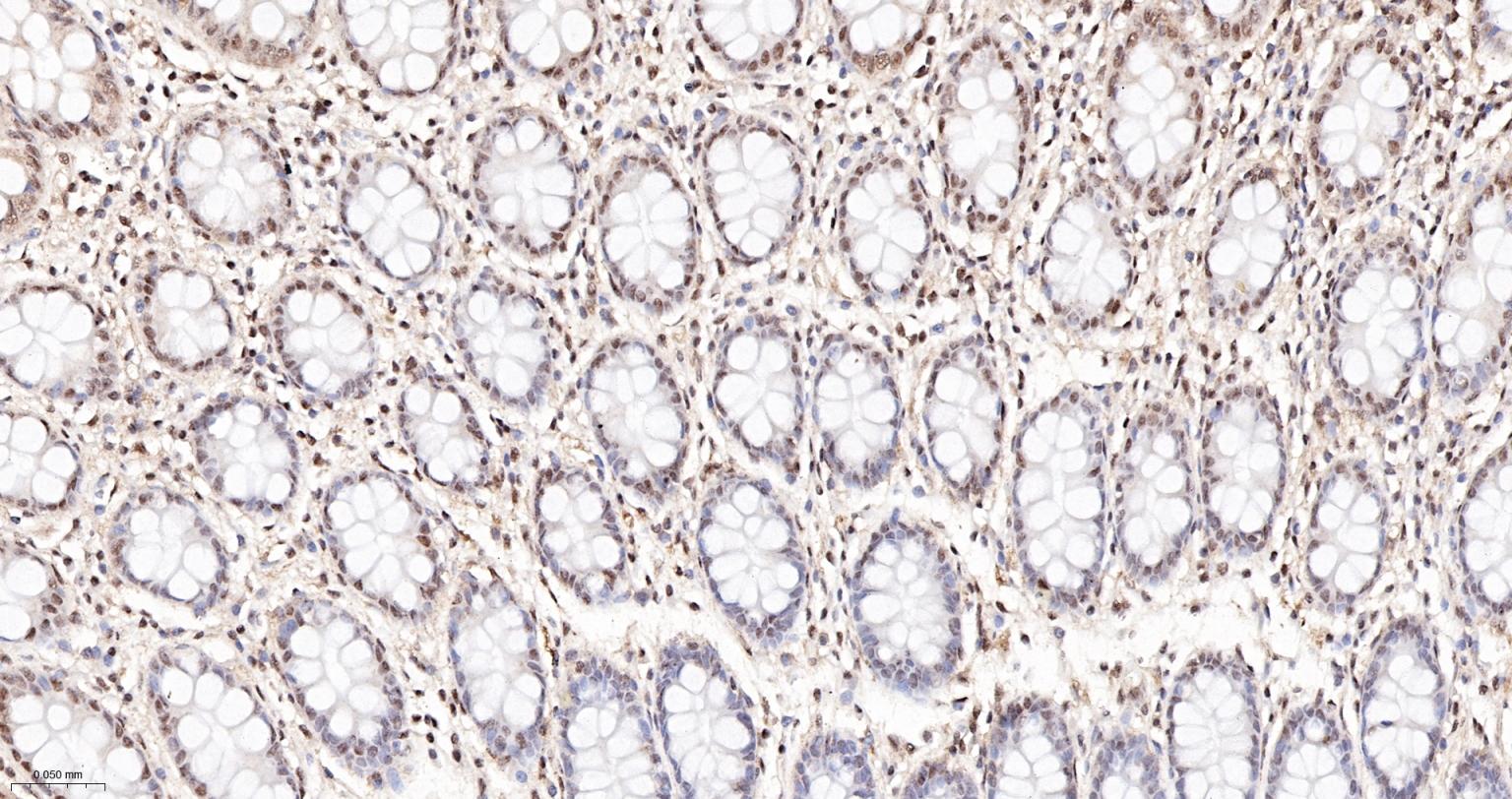 缺氧诱导因子1α抑制蛋白/HIF1AN重组兔单抗