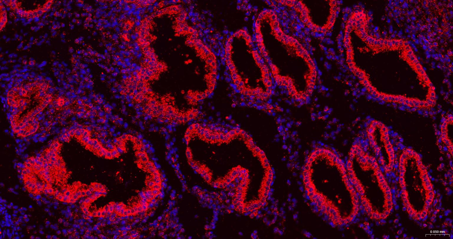 三磷酸腺苷结合转运蛋白G超家族成员2重组兔单抗