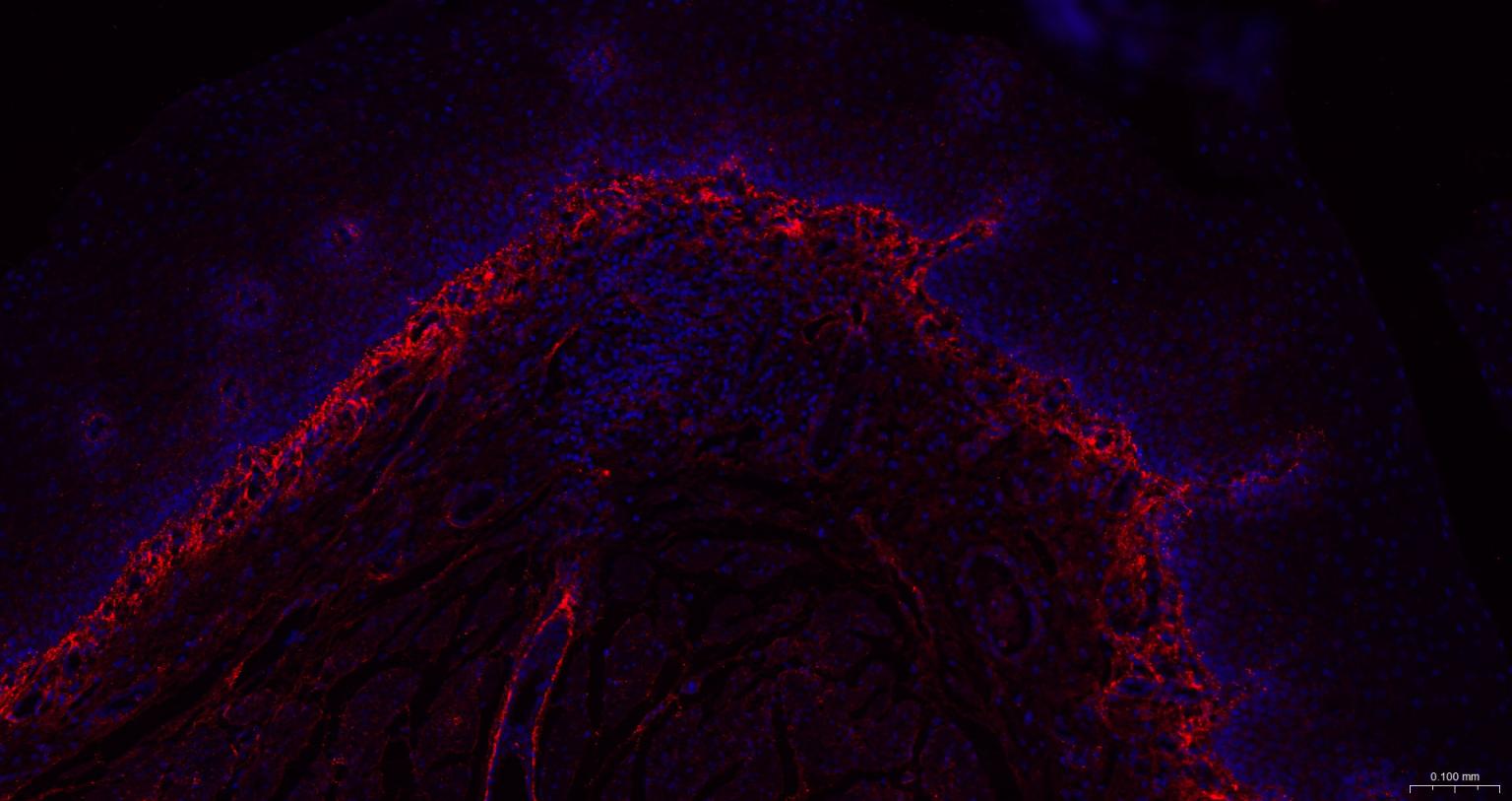 Ⅲ型胶原蛋白/胶原蛋白3/3型胶原蛋白/III型胶原抗体-bs-0549R