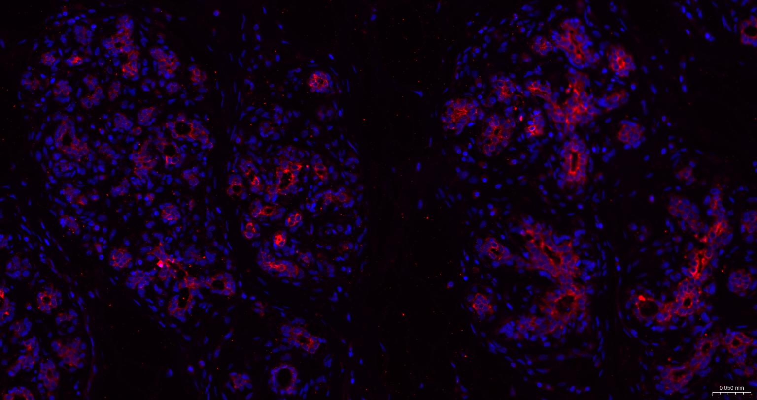 广谱细胞角蛋白PCK抗体
