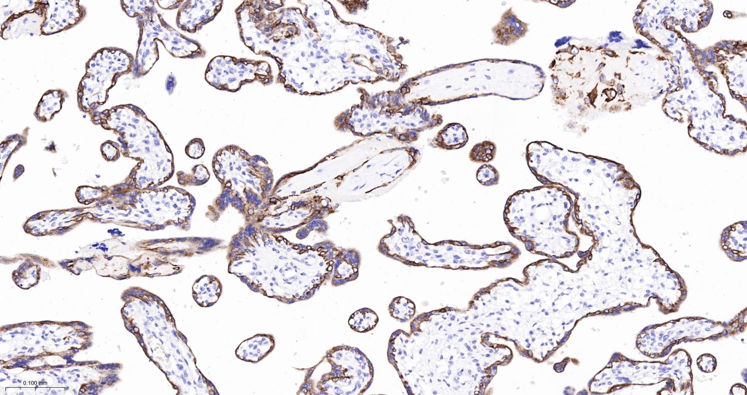 细胞角蛋白7重组兔单抗-bsm-60218R