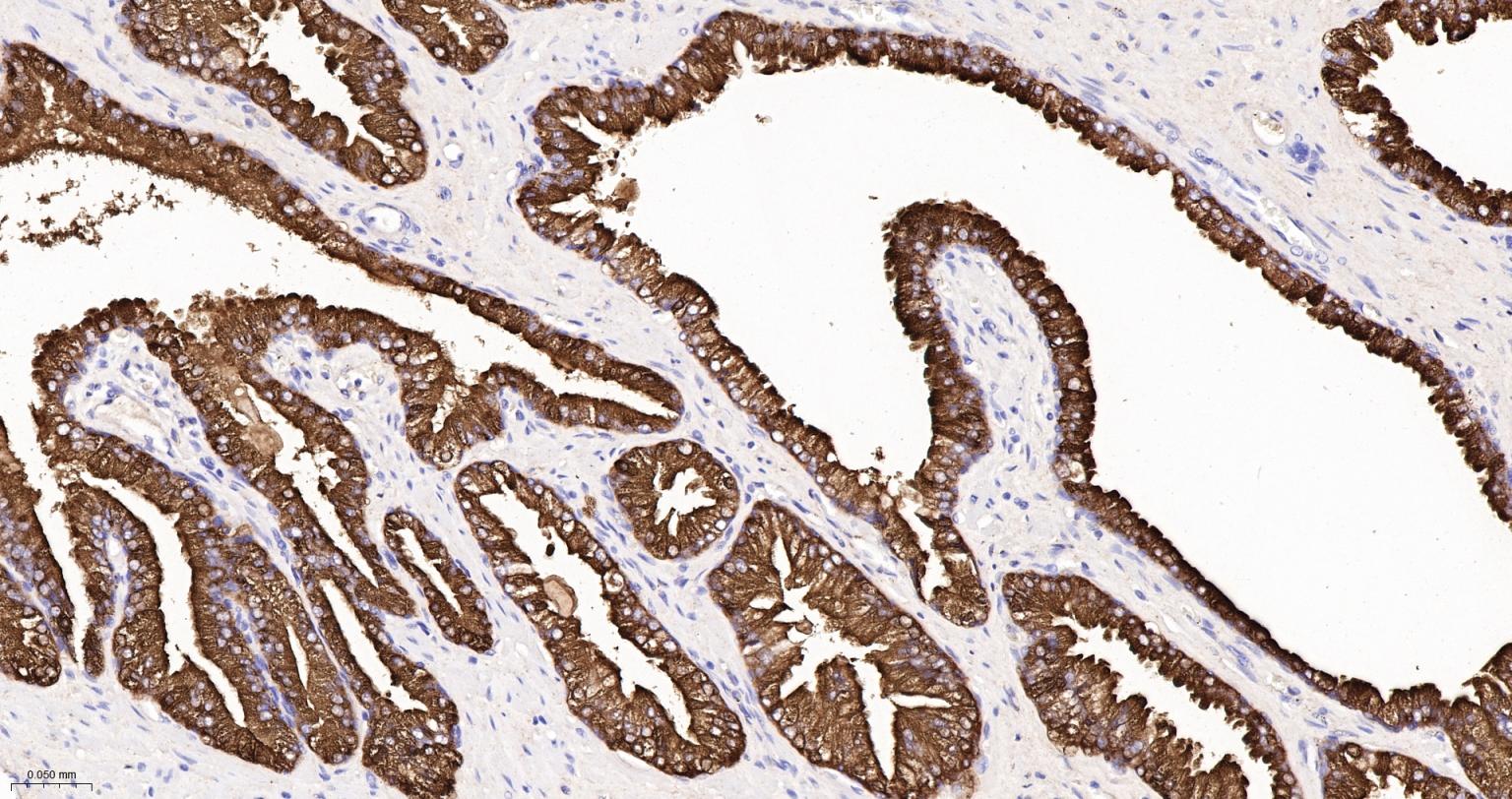 人前列腺特异性抗原重组兔单抗-bsm-61304R