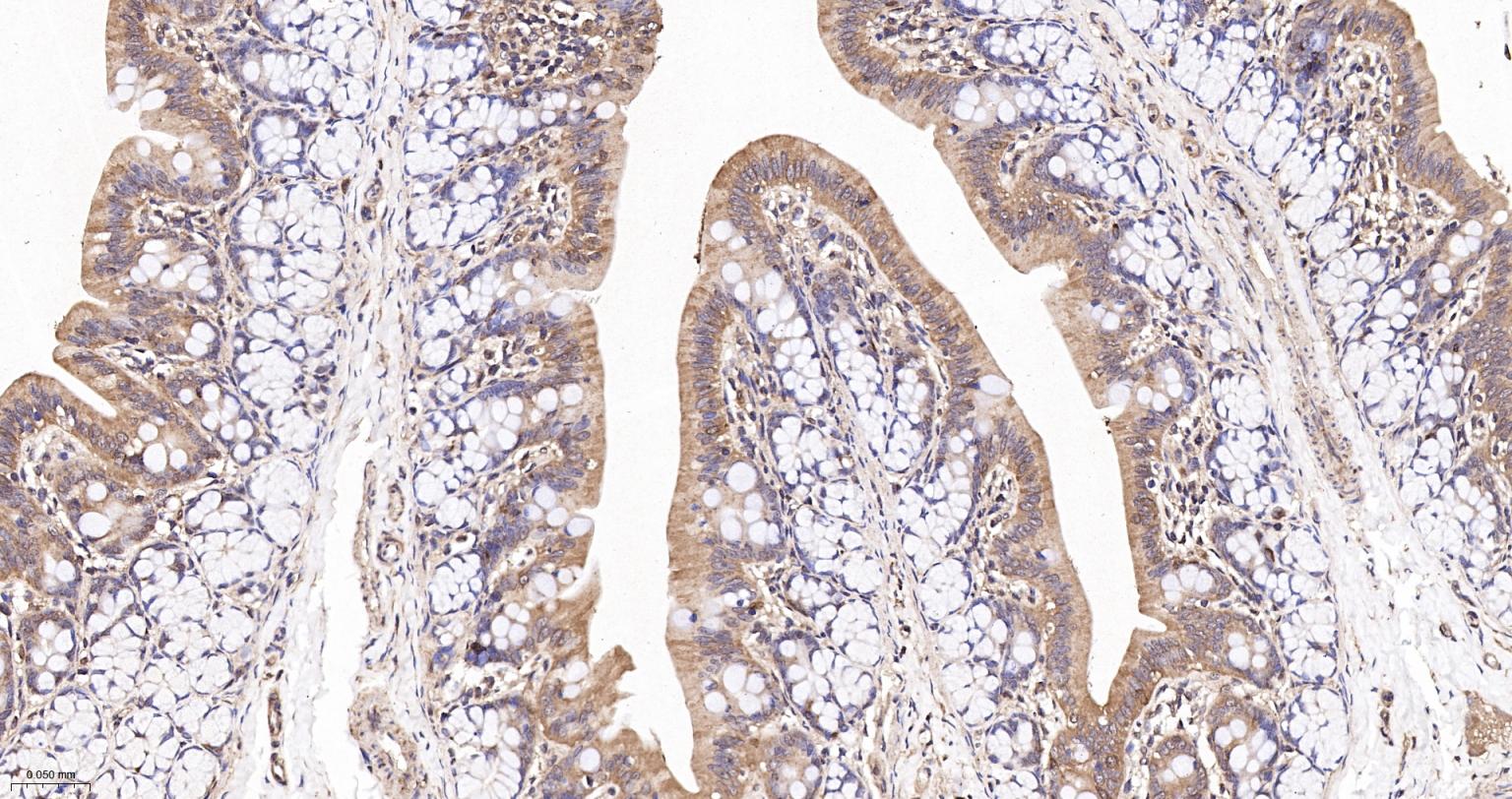 RhoA/B/C重组兔单抗