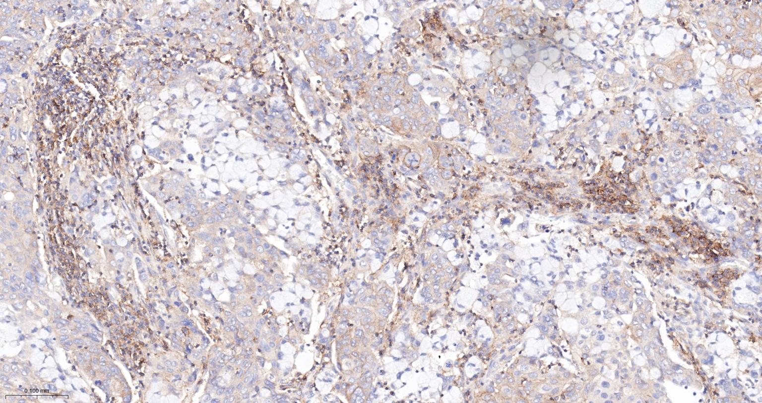 一种肿瘤抑制基因抗体