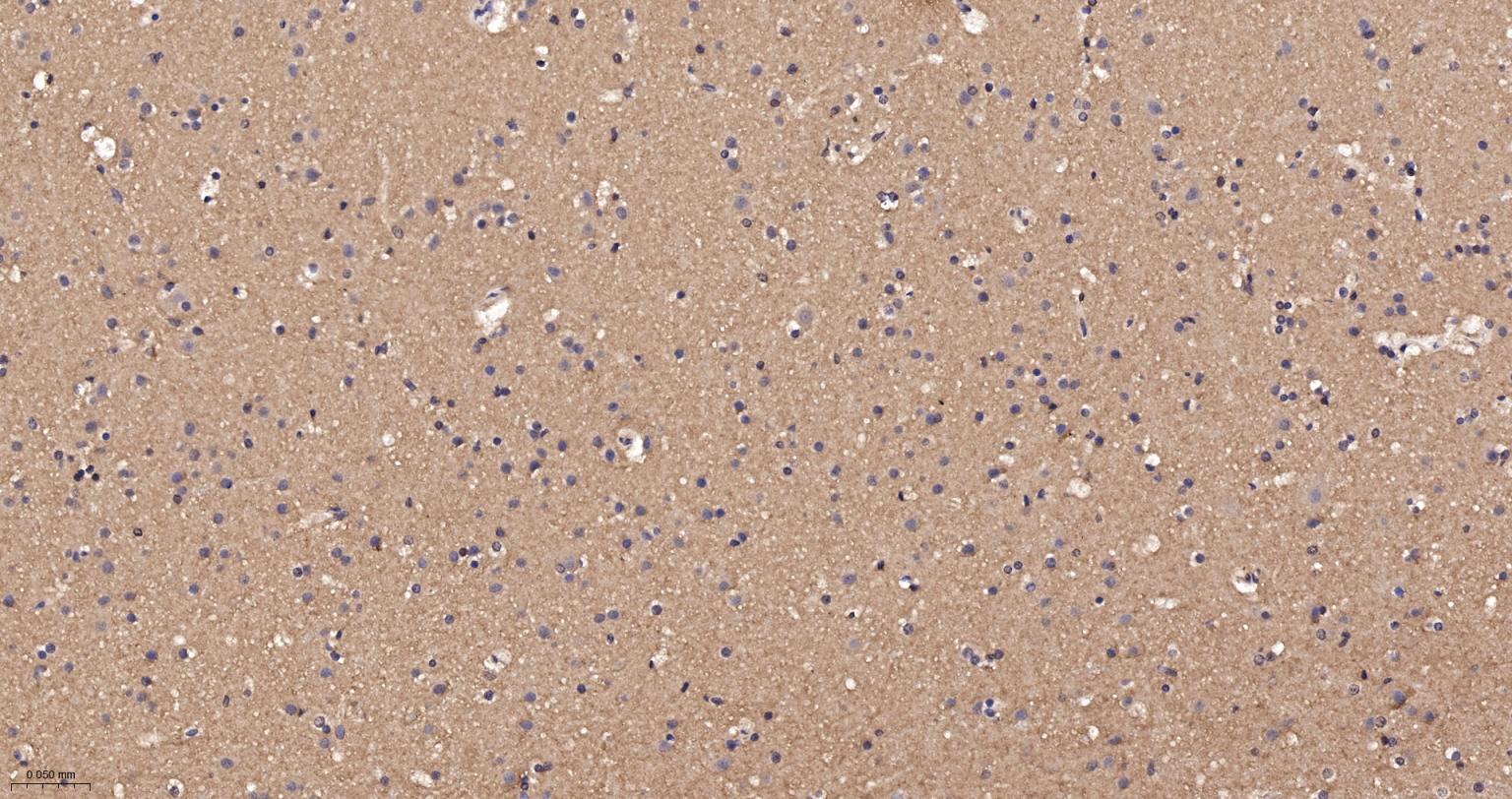 RhoA/B/C重组兔单抗