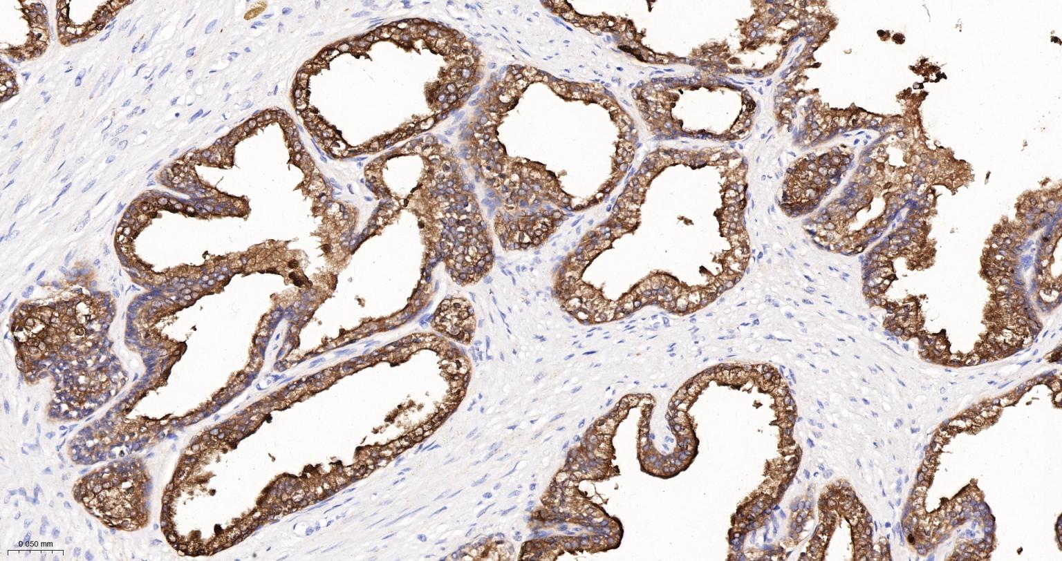PSA Recombinant Rabbit mAb (一抗) - IHC-P,IHC-F,IF | Bioss