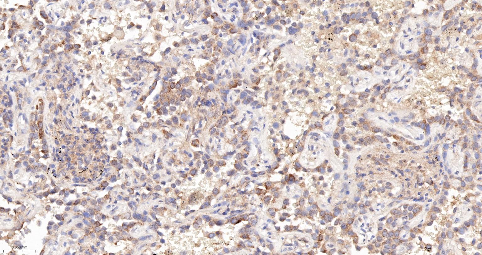 一种肿瘤抑制基因抗体