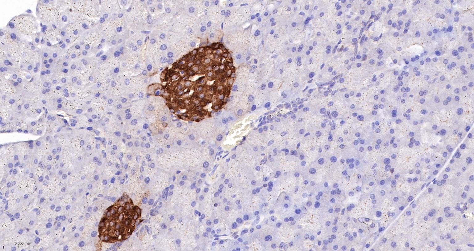 一种肿瘤抑制基因抗体