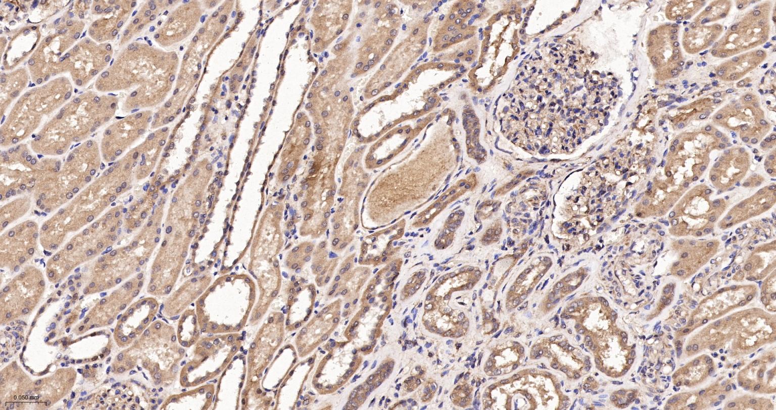 RhoA/B/C重组兔单抗