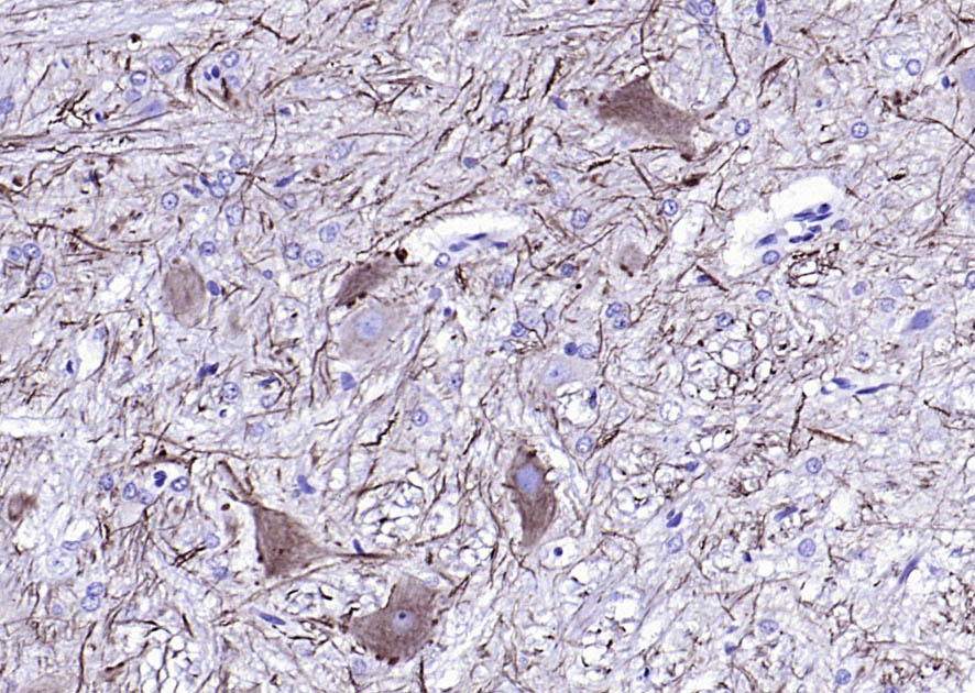 低分子量神经丝蛋白单克隆抗体-bsm-41724M