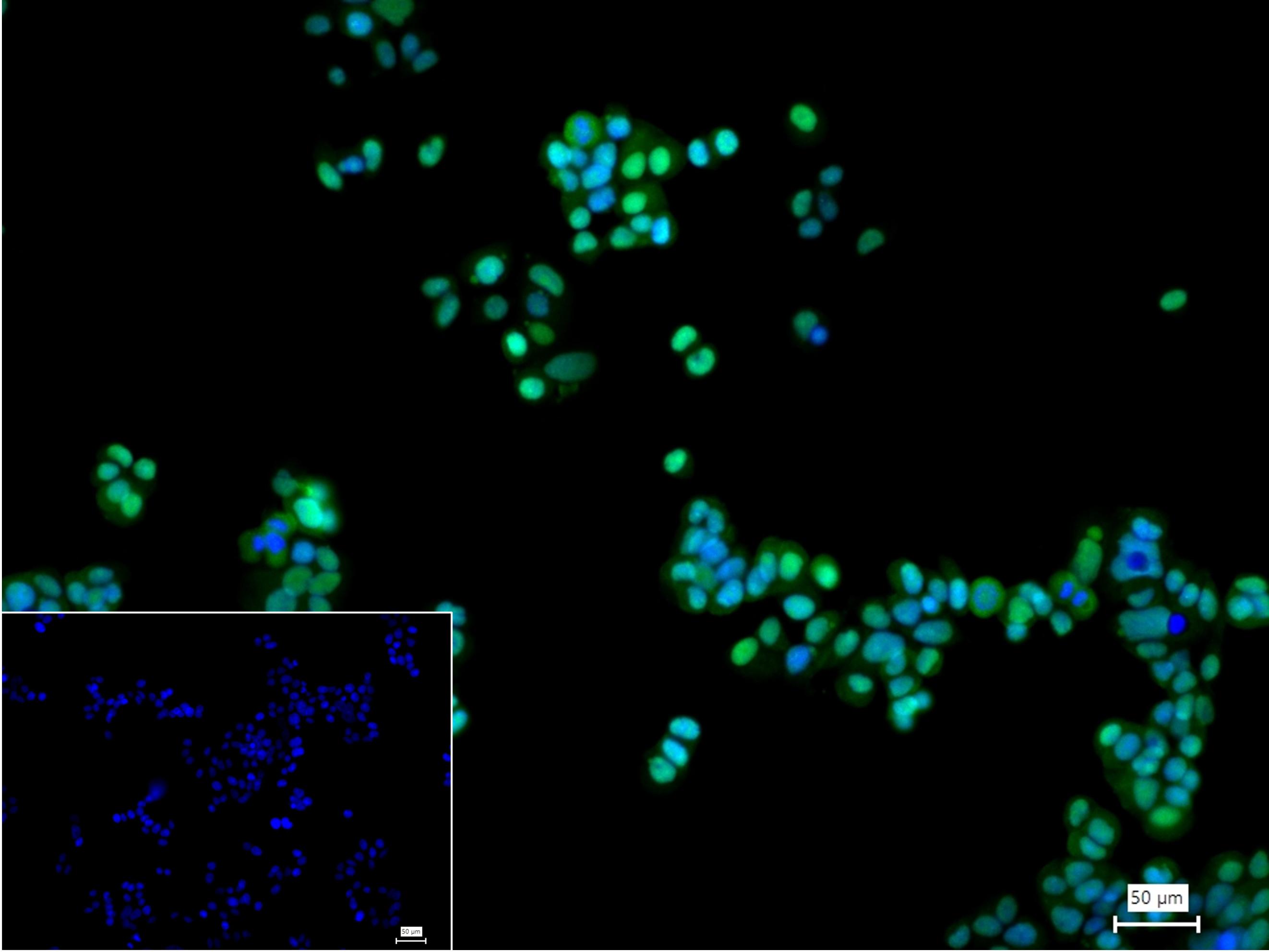 磷酸化双微体2癌基因重组兔单抗