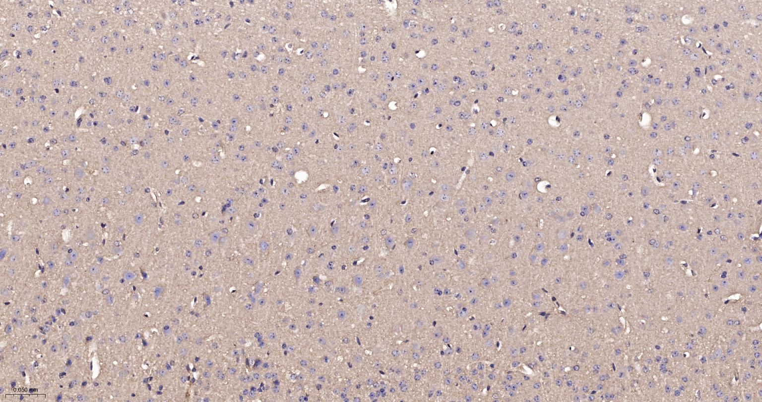 RhoA/B/C重组兔单抗