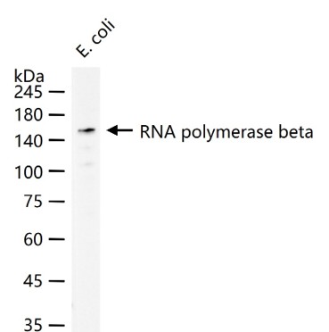 RNA聚合酶β重组兔单抗