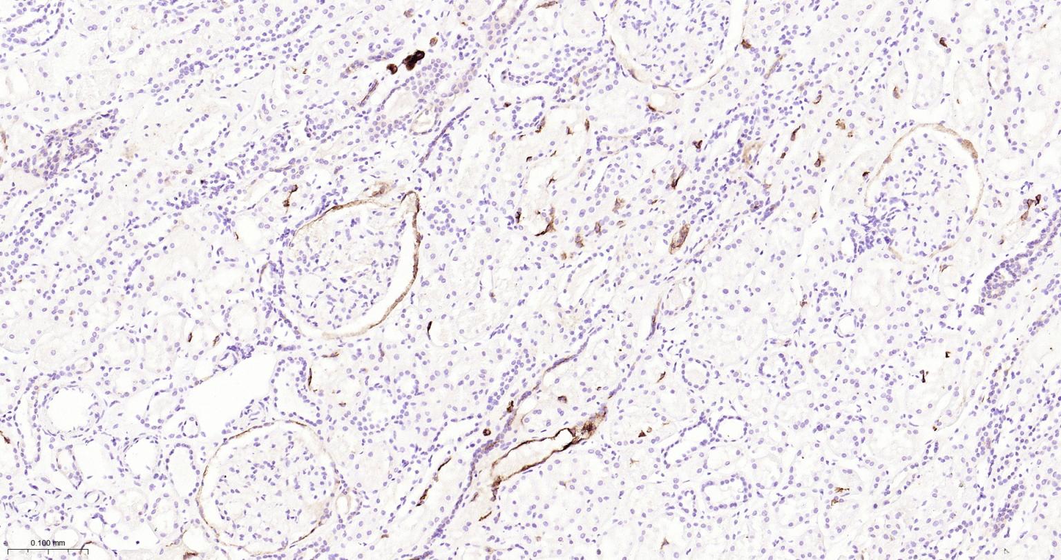 造血干细胞抗原CD133重组兔单抗