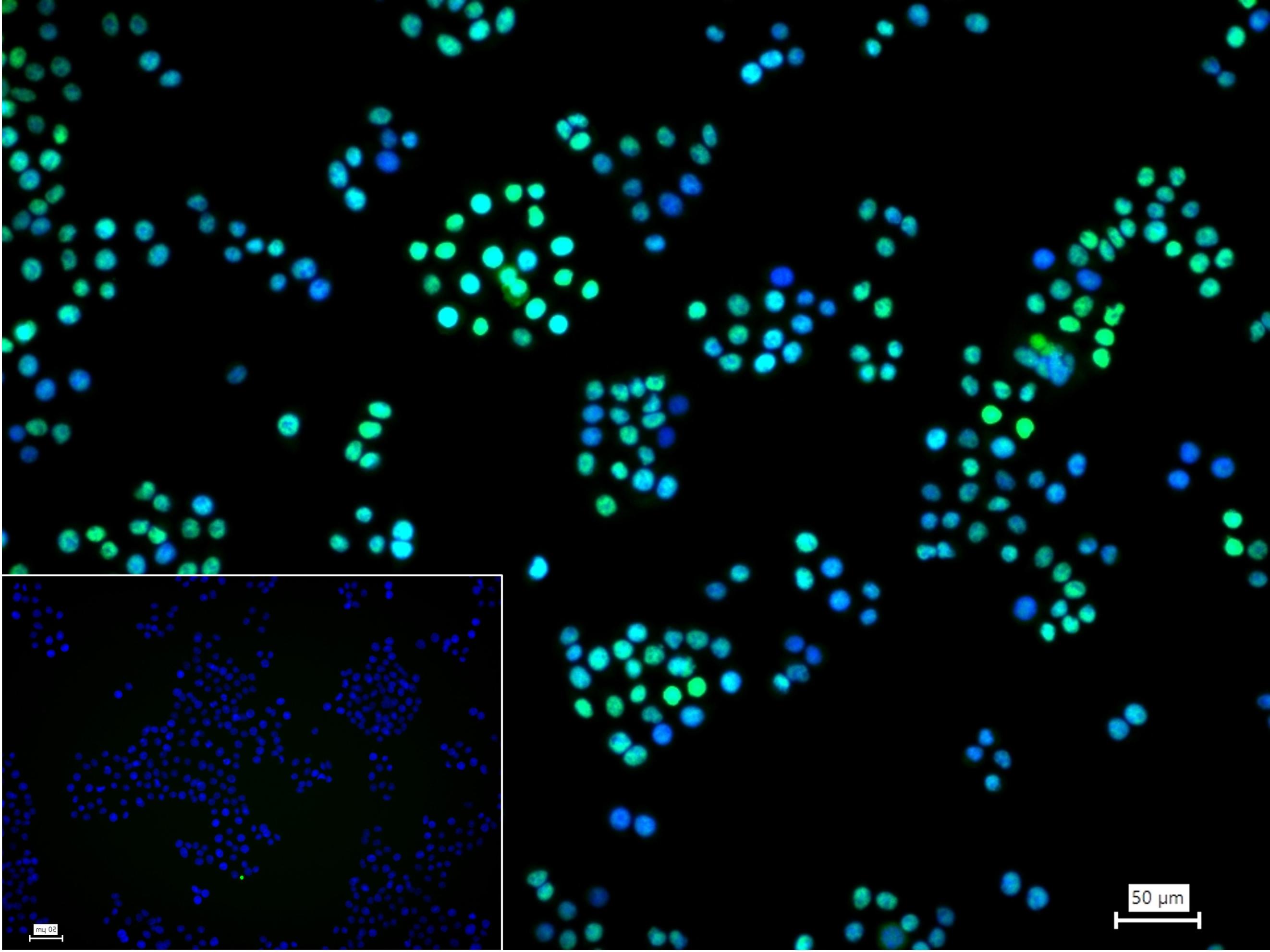 细胞肿瘤抗原P53抗体