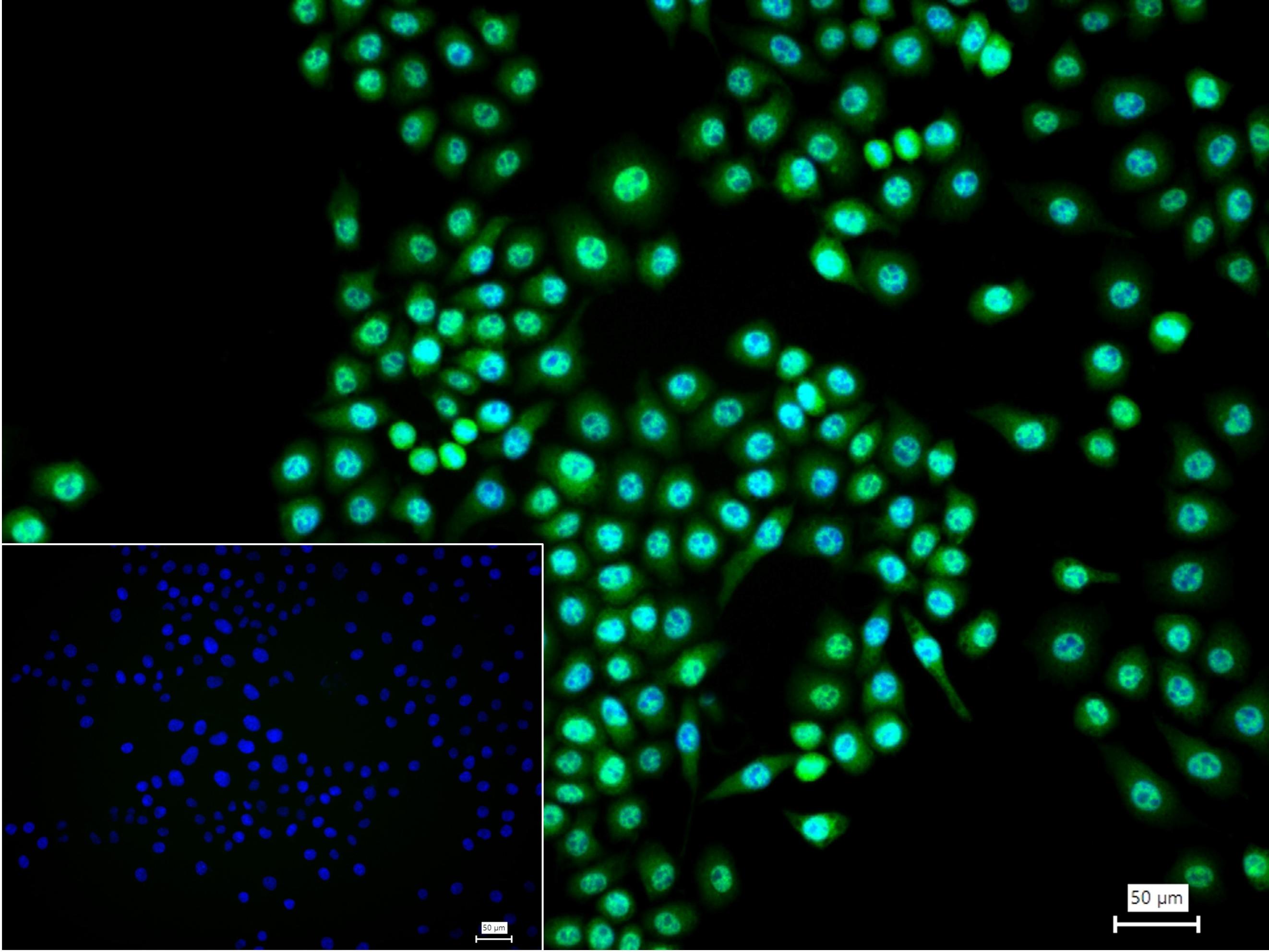 p21激活激酶2重组兔单抗