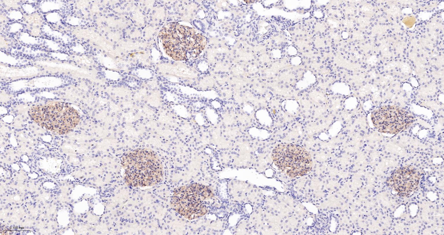 胞质紧密粘连蛋白1/闭锁小带蛋白1重组兔单抗