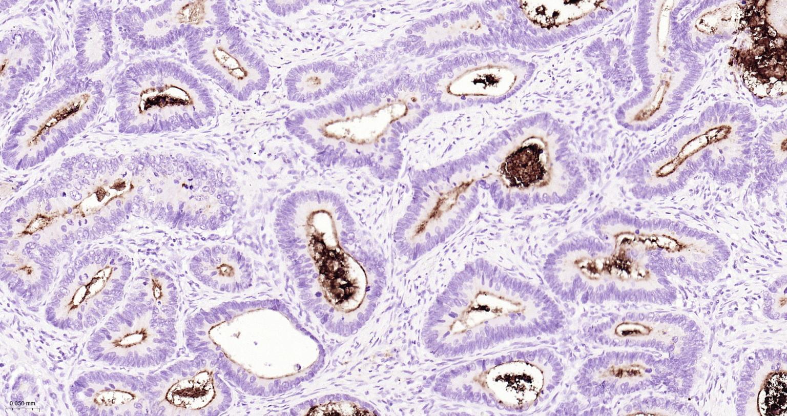 造血干细胞抗原CD133重组兔单抗