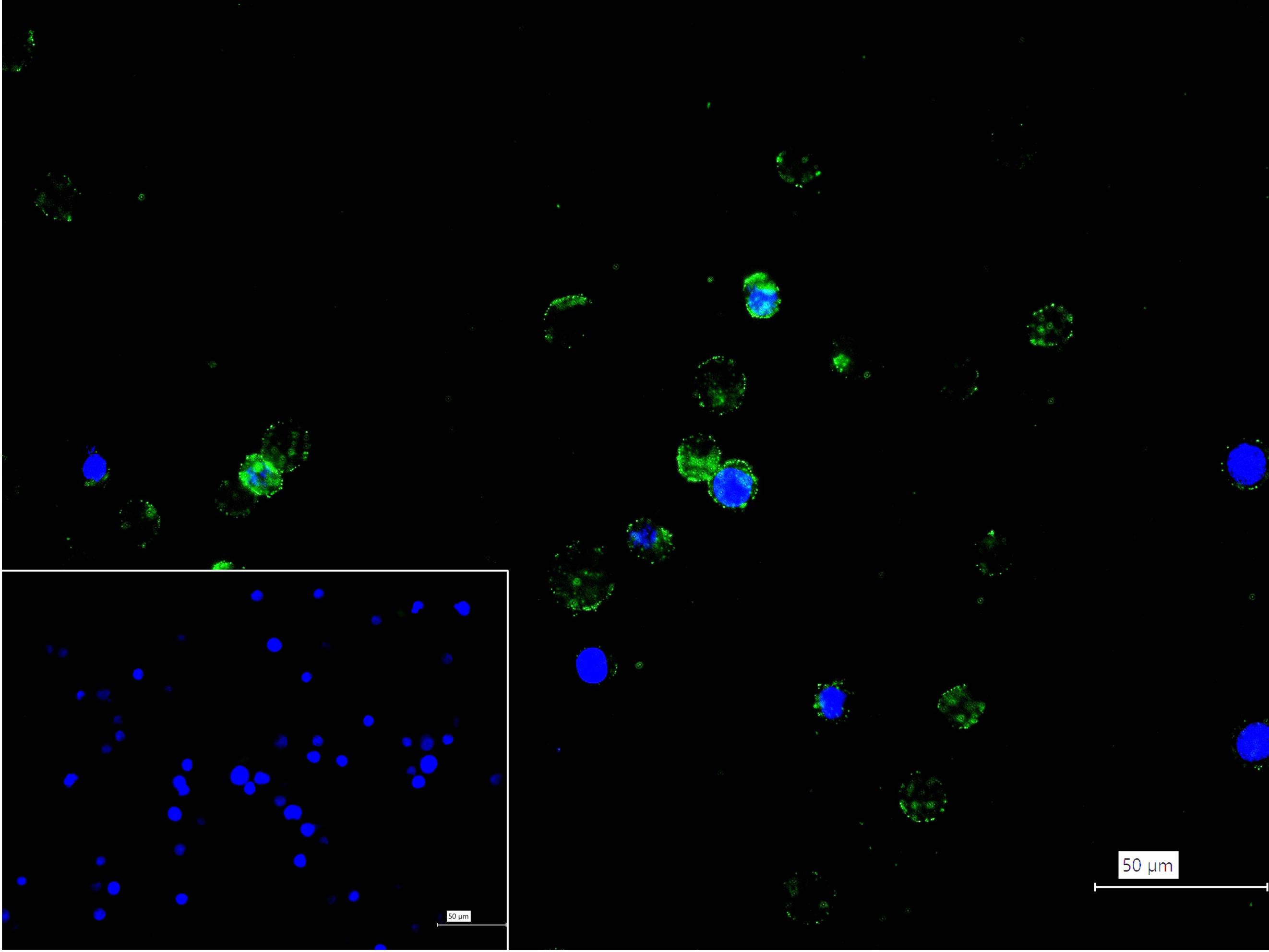 P选择素糖蛋白配体1重组兔单抗