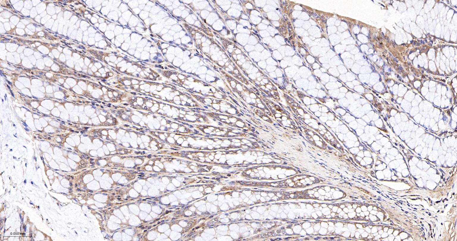 RhoA/B/C重组兔单抗