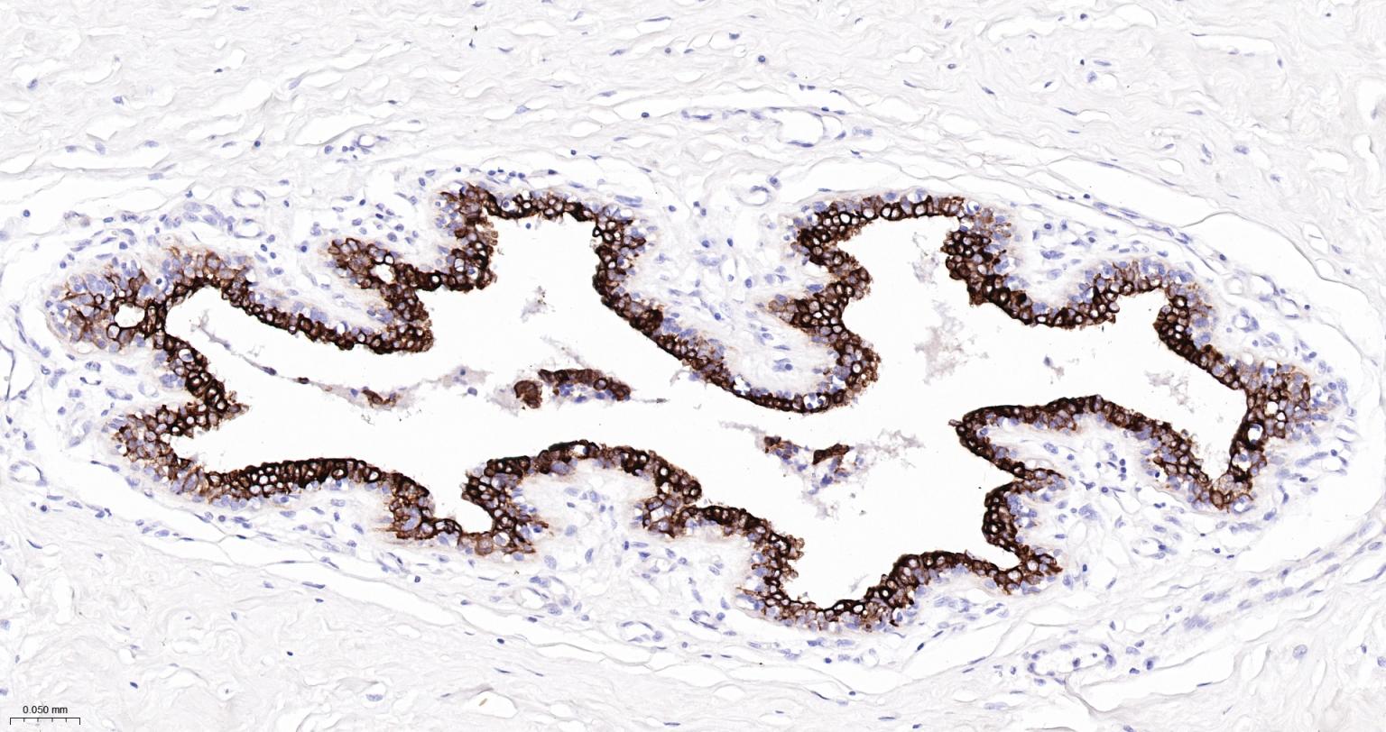 细胞角蛋白7重组兔单抗-bsm-60218R