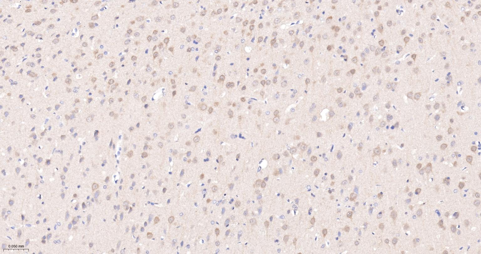 一种肿瘤抑制基因抗体