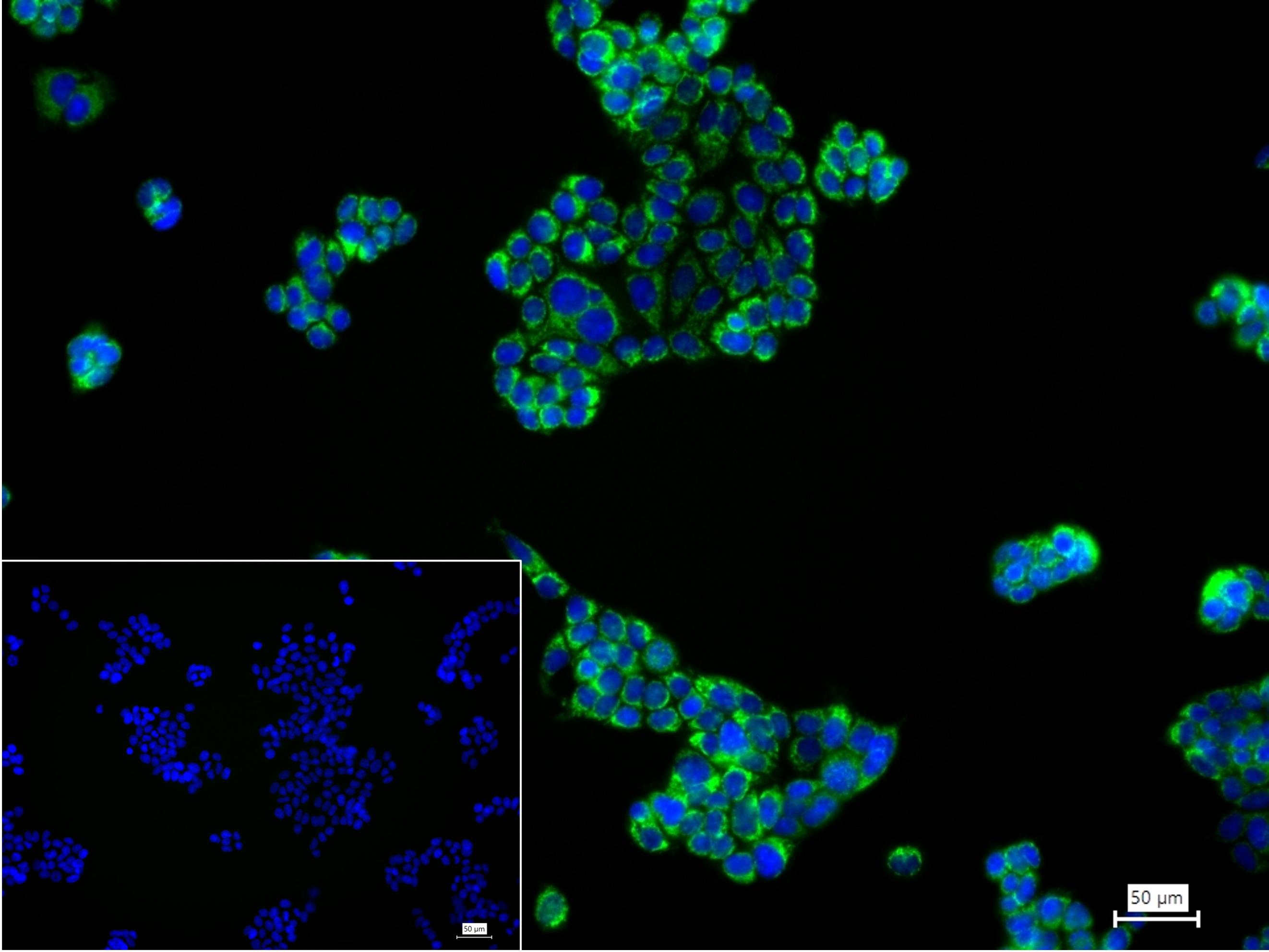 己糖激酶1重组兔单抗