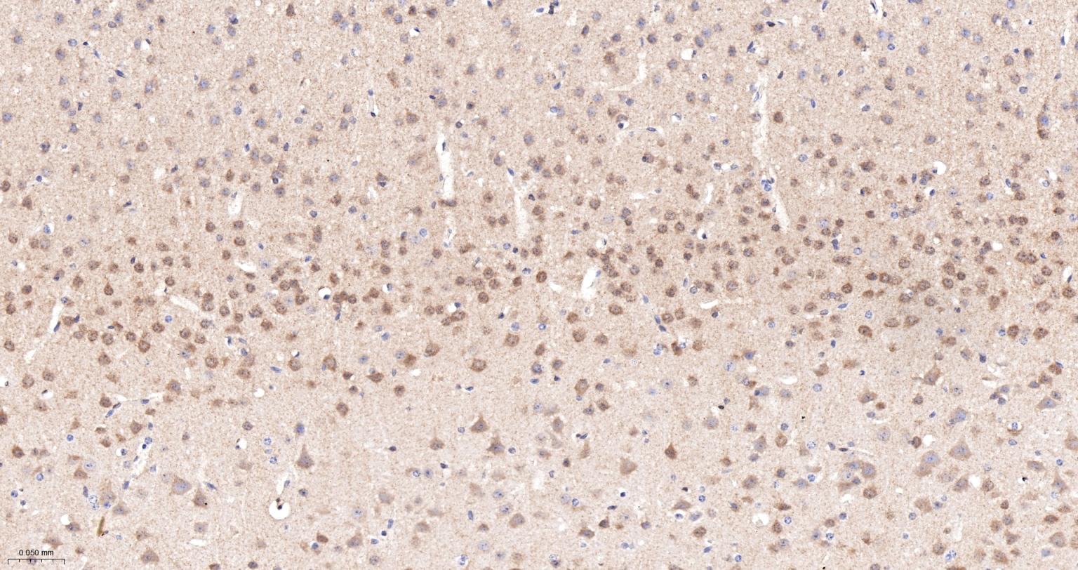 一种肿瘤抑制基因抗体