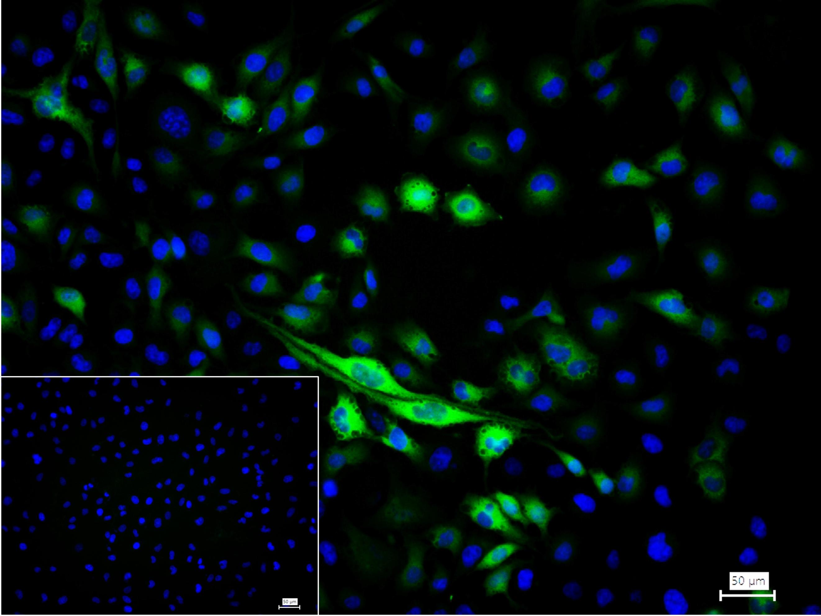 谷氨酰胺转胺酶2重组鼠单抗-bsm-55524M