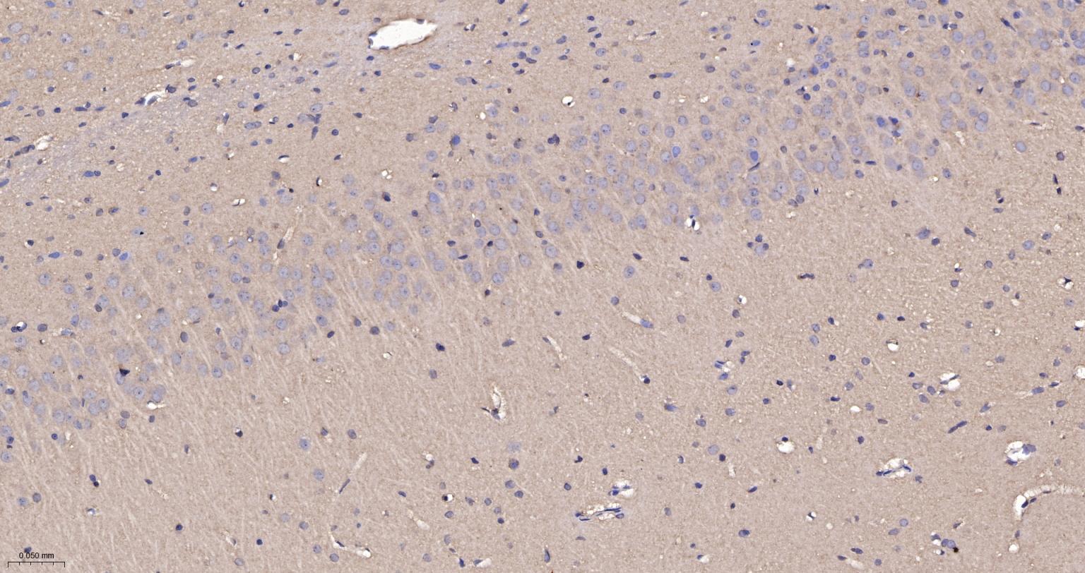 RhoA/B/C重组兔单抗