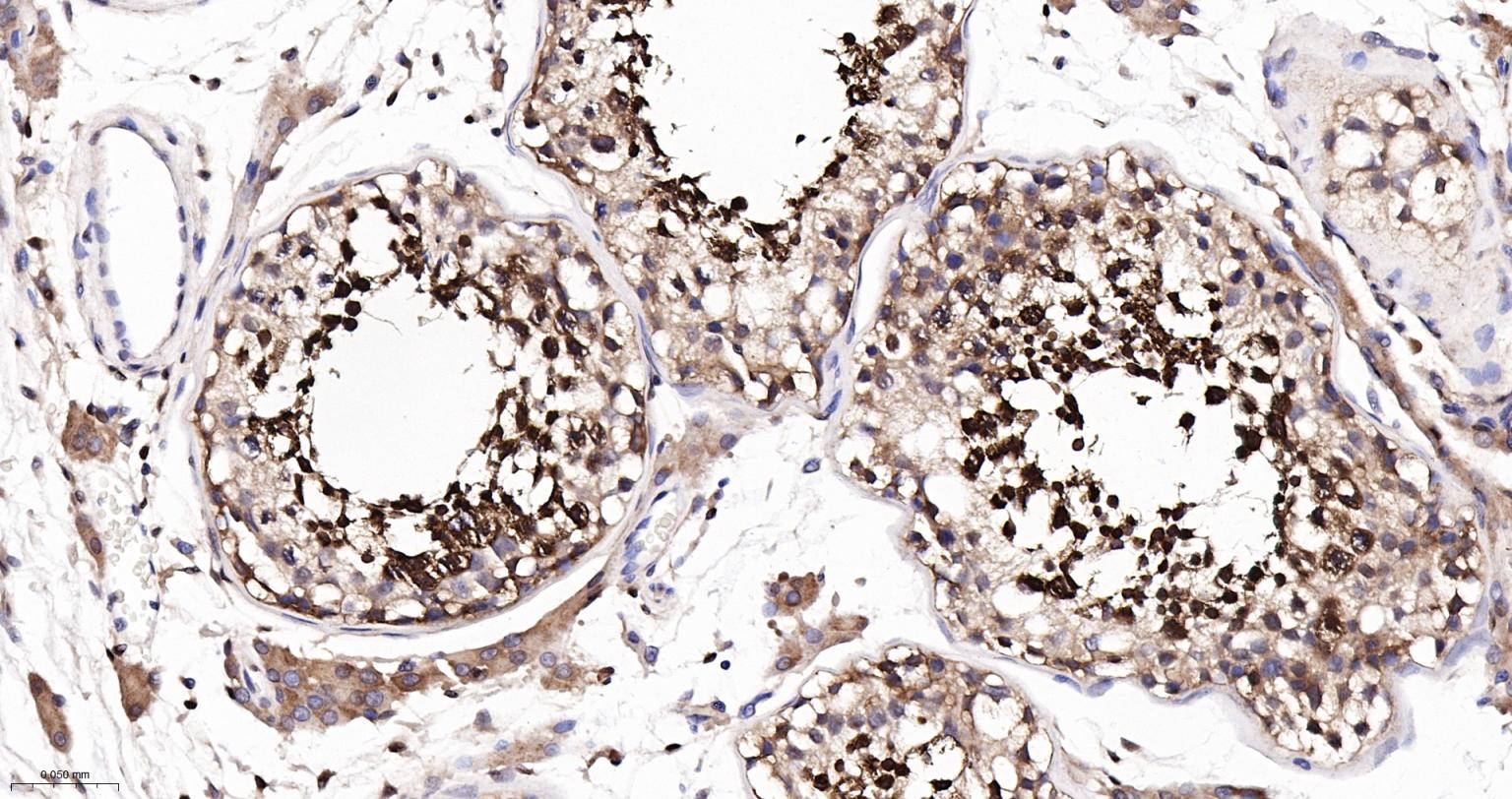 热休克蛋白-70重组兔单抗