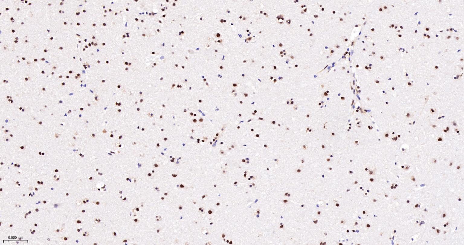 蛋白酪氨酸激酶BAP135重组兔单抗