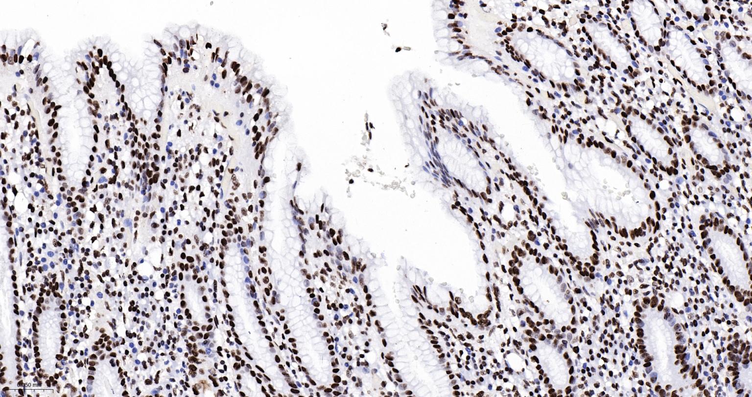 组蛋白H2AX重组兔单抗