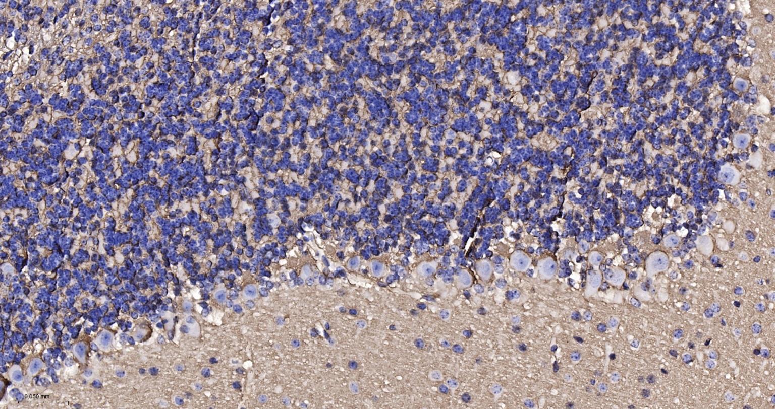 水通道蛋白4重组兔单抗