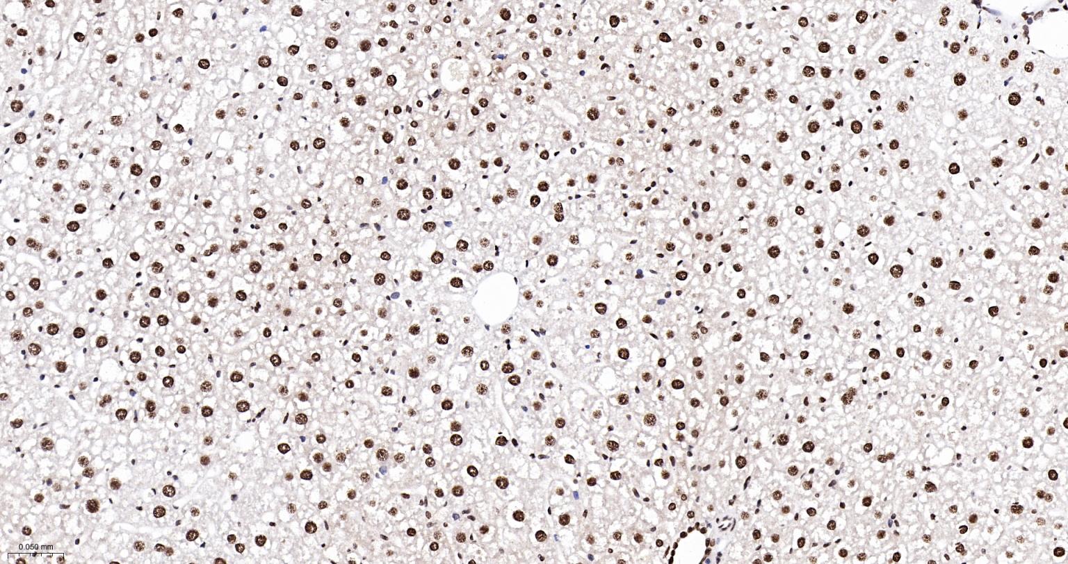 异型组蛋白H2A.1重组兔单抗-bsm-61665R