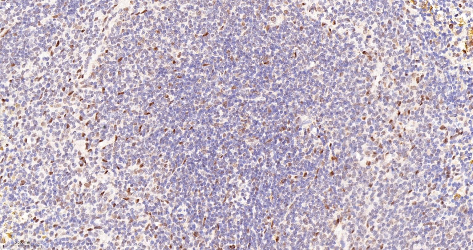 蛋白酪氨酸激酶BAP135重组兔单抗