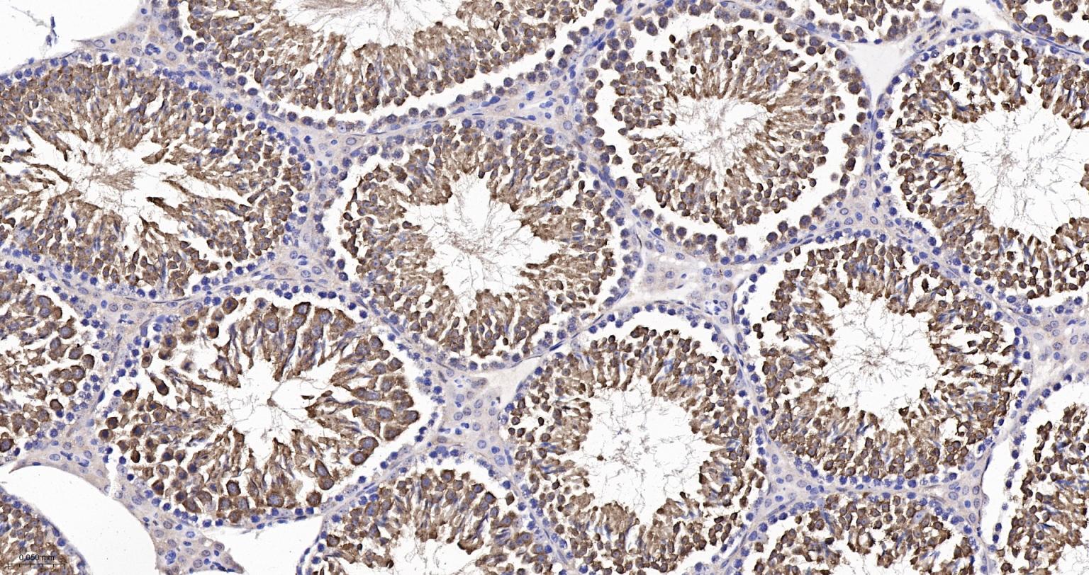 热休克蛋白-70重组兔单抗