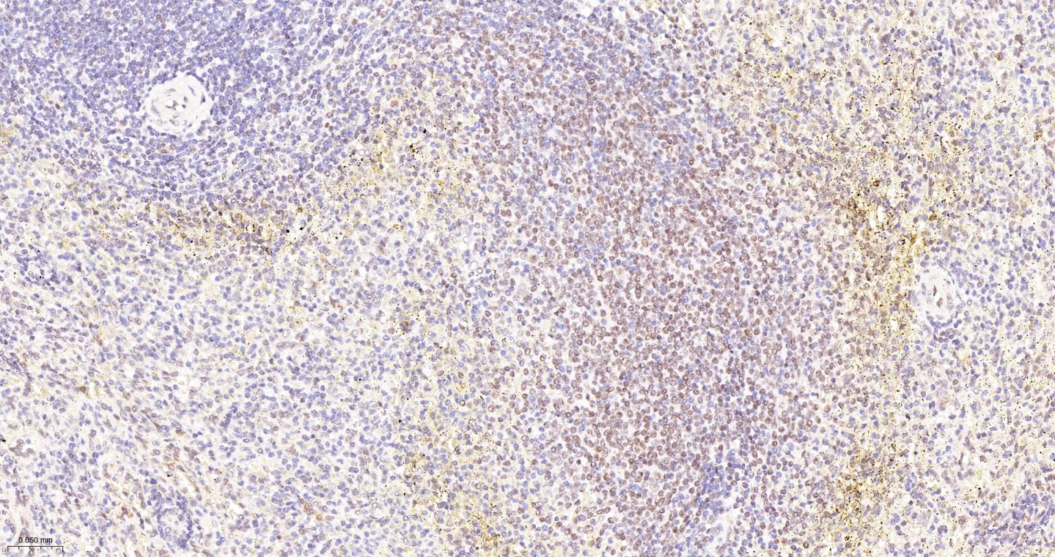 蛋白酪氨酸激酶BAP135重组兔单抗