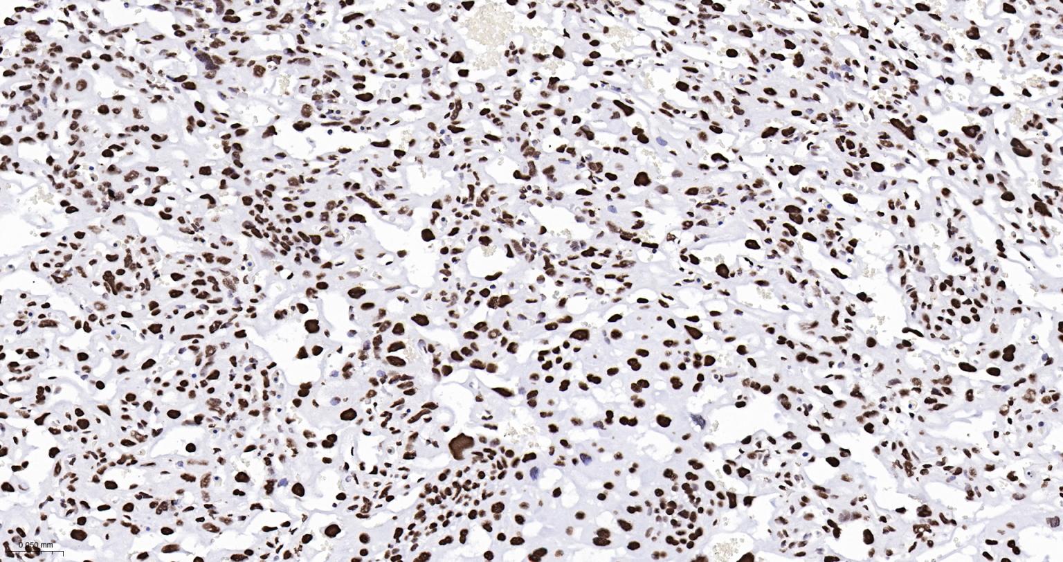 组蛋白H2AX重组兔单抗